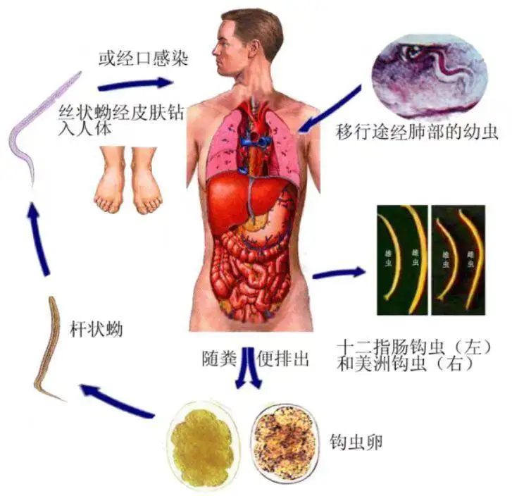 狗钩虫病(狗钩虫病那个药最好)