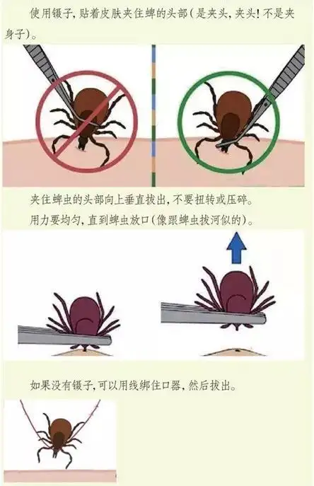 蜱虫一般在哪里会出现(蜱虫一般在哪里会出现地区)