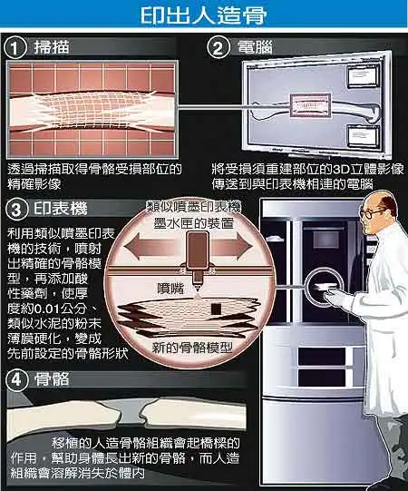 人造骨头可以维持多少年(人造骨头可以维持多少年寿命呢)